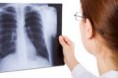 /album/fotogaleria-imagenologia/radiografia-de-torax-jpg/